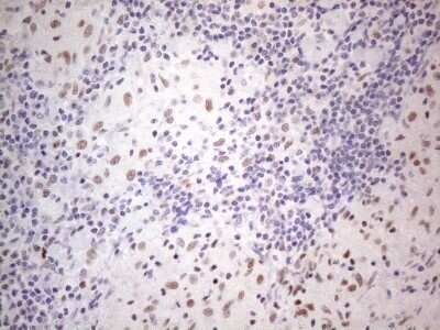 Immunohistochemistry: TDG Antibody (OTI3C11) - Azide and BSA Free [NBP2-74484]