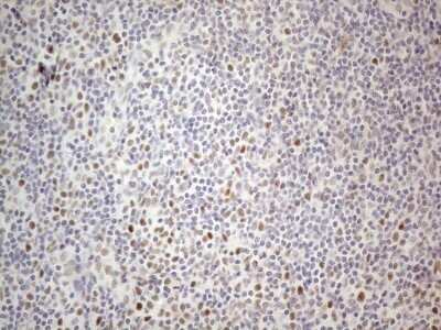 Immunohistochemistry: TDG Antibody (OTI3C11) - Azide and BSA Free [NBP2-74484]