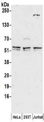 Western Blot: TDG Antibody [NBP2-32248]