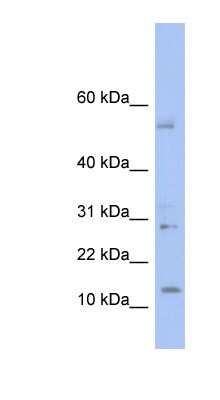 Western Blot: TDI Antibody [NBP1-70721]