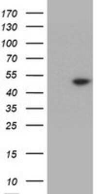 Western Blot: TDO2 Antibody (OTI1D1) [NBP2-02002]