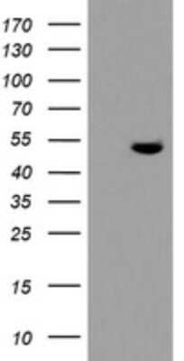 Western Blot: TDO2 Antibody (OTI2A4) [NBP2-45995]