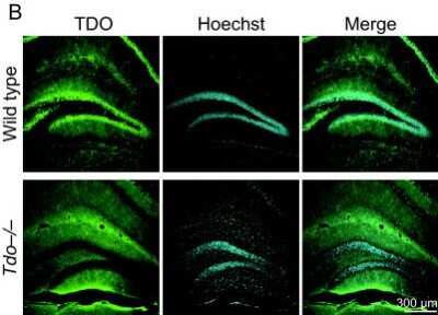 Immunohistochemistry: TDO2 Antibody [H00006999-B01P]