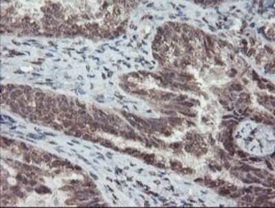 Immunohistochemistry: TDO2 Antibody (OTI2A4) - Azide and BSA Free [NBP2-74486]