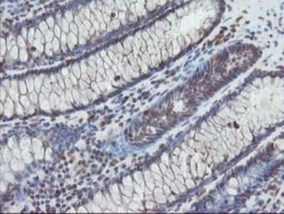 Immunohistochemistry: TDO2 Antibody (OTI2A4) - Azide and BSA Free [NBP2-74486]