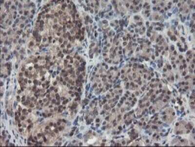 Immunohistochemistry: TDO2 Antibody (OTI2A4) - Azide and BSA Free [NBP2-74486]
