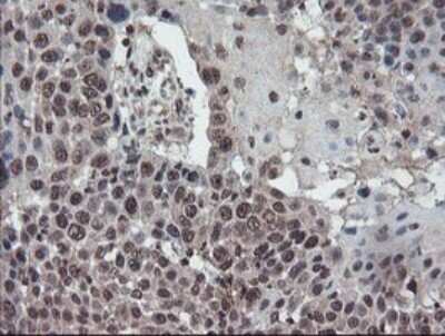 Immunohistochemistry: TDO2 Antibody (OTI2A4) - Azide and BSA Free [NBP2-74486]
