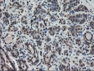 Immunohistochemistry: TDO2 Antibody (OTI2A4) - Azide and BSA Free [NBP2-74486]