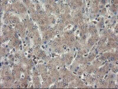 Immunohistochemistry: TDO2 Antibody (OTI2A4) - Azide and BSA Free [NBP2-74486]