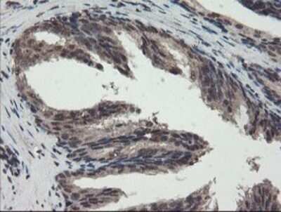 Immunohistochemistry: TDO2 Antibody (OTI2A4) - Azide and BSA Free [NBP2-74486]