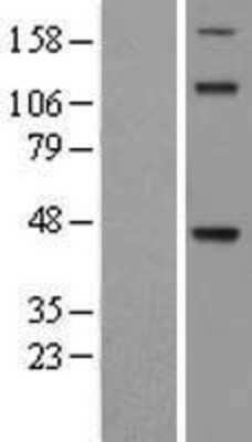 Western Blot: TDO2 Overexpression Lysate [NBL1-16799]