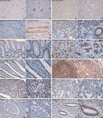 Immunohistochemistry-Paraffin: TDP-43/TARDBP Antibody (2E2-D3) [H00023435-M01]