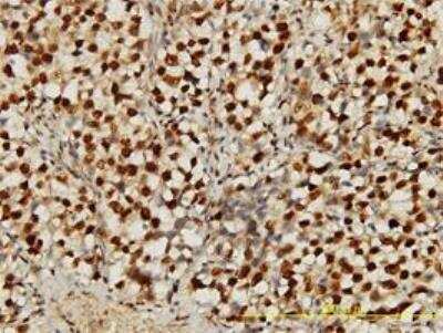 Immunohistochemistry-Paraffin: TDP-43/TARDBP Antibody (2E2-D3) [H00023435-M01]