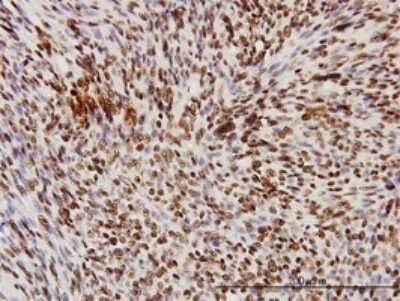 Immunohistochemistry-Paraffin: TDP-43/TARDBP Antibody (2E2-D3) [H00023435-M01]
