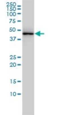 Western Blot: TDP-43/TARDBP Antibody (2E2-D3) [H00023435-M01]