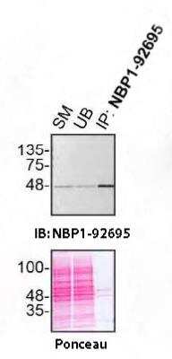 Immunoprecipitation: TDP-43/TARDBP Antibody (3H8) [NBP1-92695]