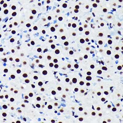 Immunohistochemistry-Paraffin: TDP-43/TARDBP Antibody (4R5L7) [NBP3-15677]