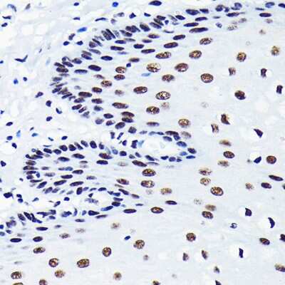 Immunohistochemistry-Paraffin: TDP-43/TARDBP Antibody (4R5L7) [NBP3-15677]