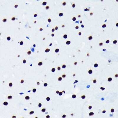 Immunohistochemistry-Paraffin: TDP-43/TARDBP Antibody (4R5L7) [NBP3-15677]
