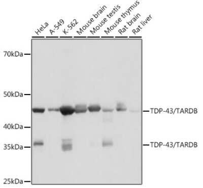 Western Blot: TDP-43/TARDBP Antibody (4R5L7) [NBP3-15677]