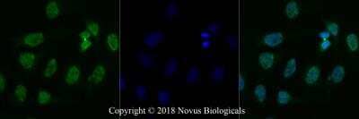 Immunocytochemistry/ Immunofluorescence: TDP-43/TARDBP Antibody - BSA Free [NB110-55376]
