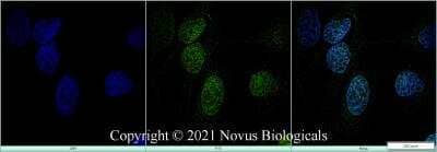 Immunocytochemistry/ Immunofluorescence: TDP-43/TARDBP Antibody - BSA Free [NB110-55376]