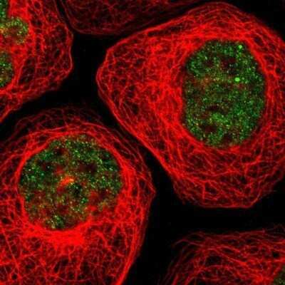 Immunocytochemistry/ Immunofluorescence: TDP-43/TARDBP Antibody [NBP1-89116]