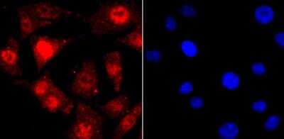 Immunocytochemistry/ Immunofluorescence: TDP-43/TARDBP Antibody (JM51-10) [NBP2-80137]