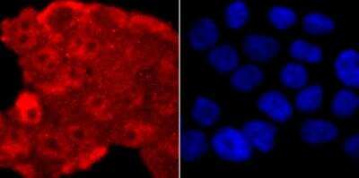 Immunocytochemistry/ Immunofluorescence: TDP-43/TARDBP Antibody (JM51-10) [NBP2-80137]