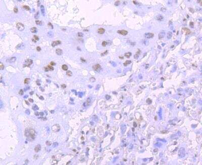 Immunohistochemistry-Paraffin: TDP-43/TARDBP Antibody (JM51-10) [NBP2-80137]