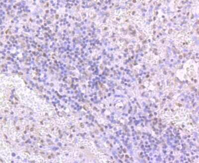 Immunohistochemistry-Paraffin: TDP-43/TARDBP Antibody (JM51-10) [NBP2-80137]