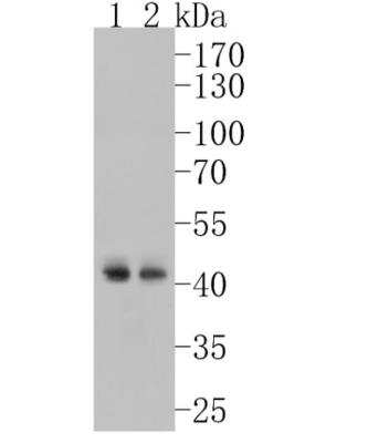 Western Blot: TDP-43/TARDBP Antibody (JM51-10) [NBP2-80137]