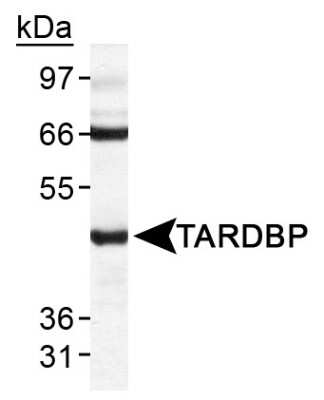 Western Blot: TDP-43/TARDBP AntibodyBSA Free [NB110-55376]
