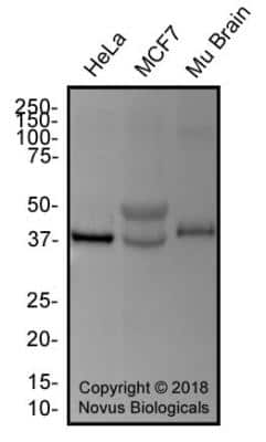 Western Blot: TDP-43/TARDBP AntibodyBSA Free [NB110-55376]