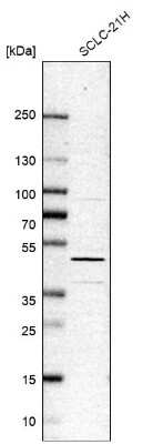 Western Blot: TDP-43/TARDBP Antibody [NBP1-89116]