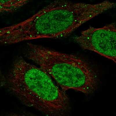 Immunocytochemistry/ Immunofluorescence: TDP1 Antibody [NBP2-56309]