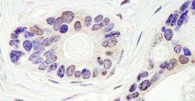 Immunohistochemistry-Paraffin: TDP1 Antibody [NB100-81642]