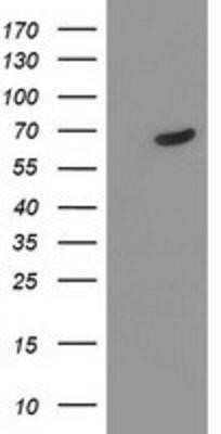 Western Blot: TDP1 Antibody (OTI4H1)Azide and BSA Free [NBP2-74487]