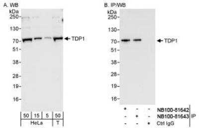 Western Blot: TDP1 Antibody [NB100-81642]