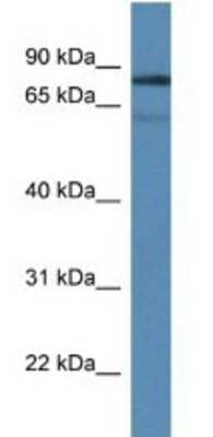 Western Blot: TDP1 Antibody [NBP1-74175]