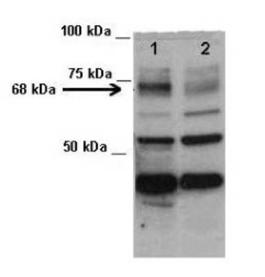 Western Blot: TDP1 Antibody [NBP1-74175]