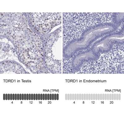 Immunohistochemistry-Paraffin: TDRD1 Antibody [NBP1-84349]