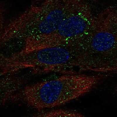 Immunocytochemistry/ Immunofluorescence: TDRD10 Antibody [NBP2-55434]