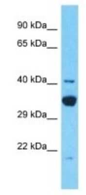 Western Blot: TDRD12 Antibody [NBP3-09894]