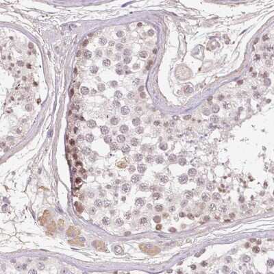 Immunohistochemistry-Paraffin: TDRD15 Antibody [NBP2-49019]