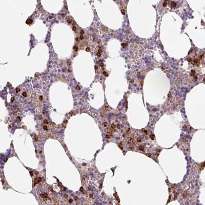 Immunohistochemistry: TDRD15 Antibody [NBP2-49146]