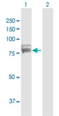 Western Blot: TDRD3 Antibody [H00081550-B01P]