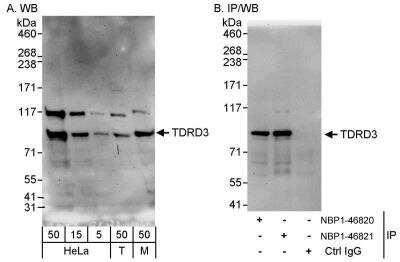 Western Blot: TDRD3 Antibody [NBP1-46821]