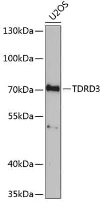 Western Blot: TDRD3 AntibodyBSA Free [NBP2-93663]