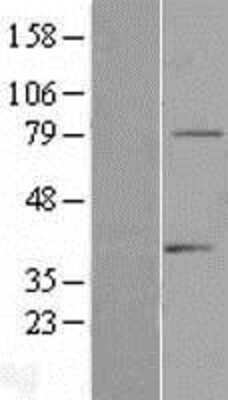 Western Blot: TDRD3 Overexpression Lysate [NBP2-06186]